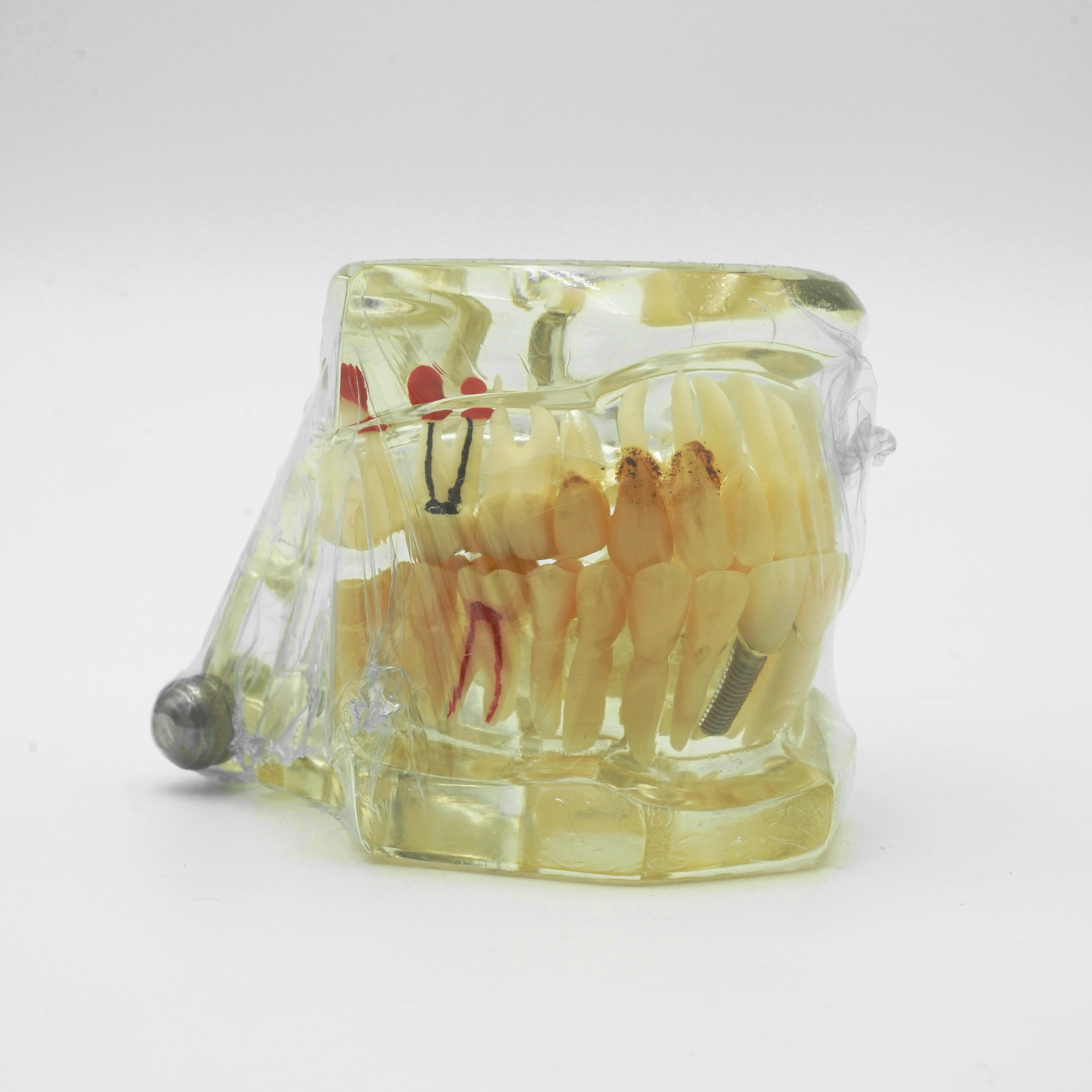Implant Model - Image 2