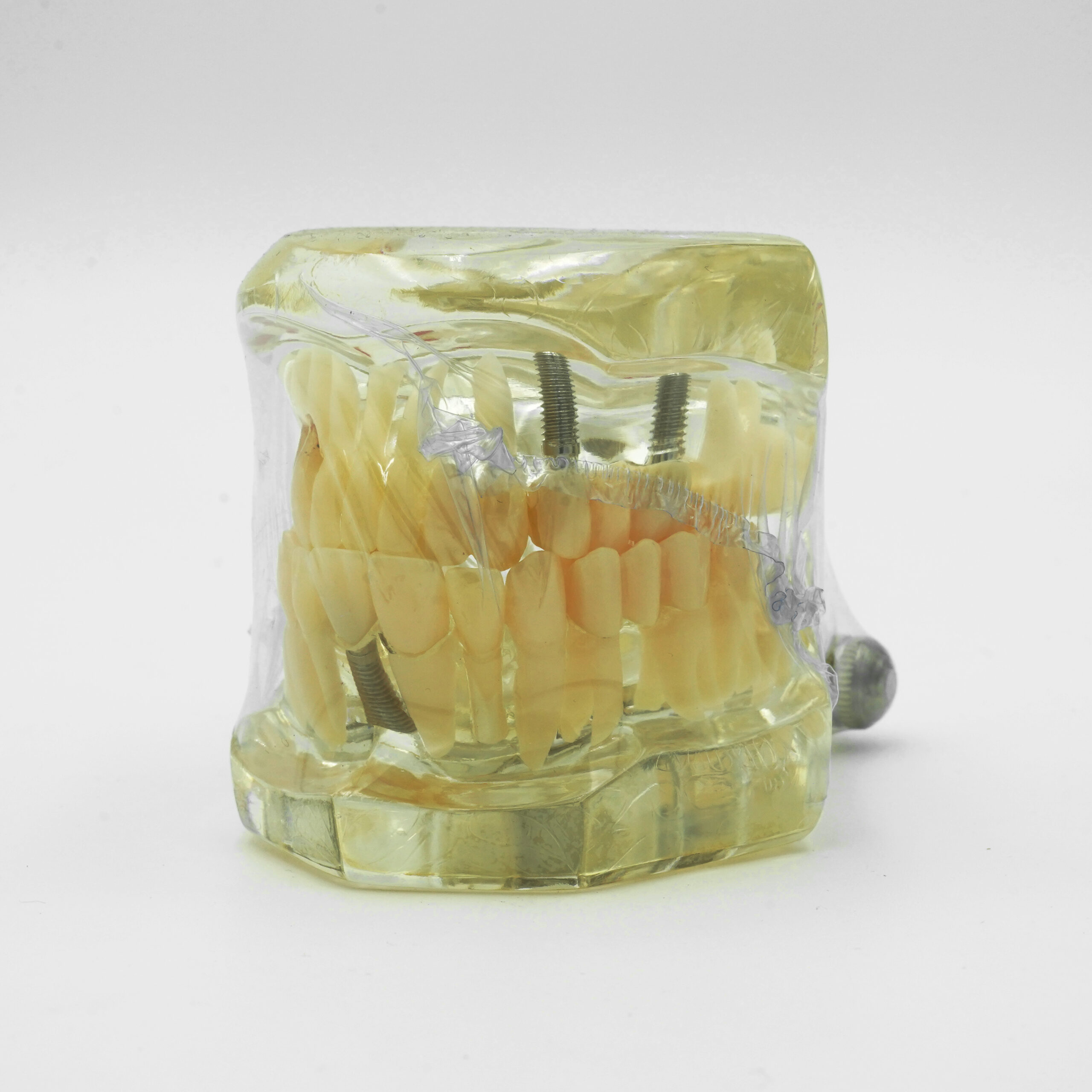 Implant Model - Image 4
